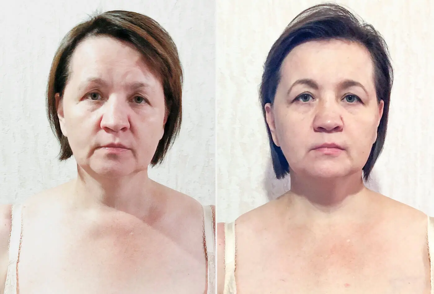 Yoga du visage rides autour de la bouche espandory