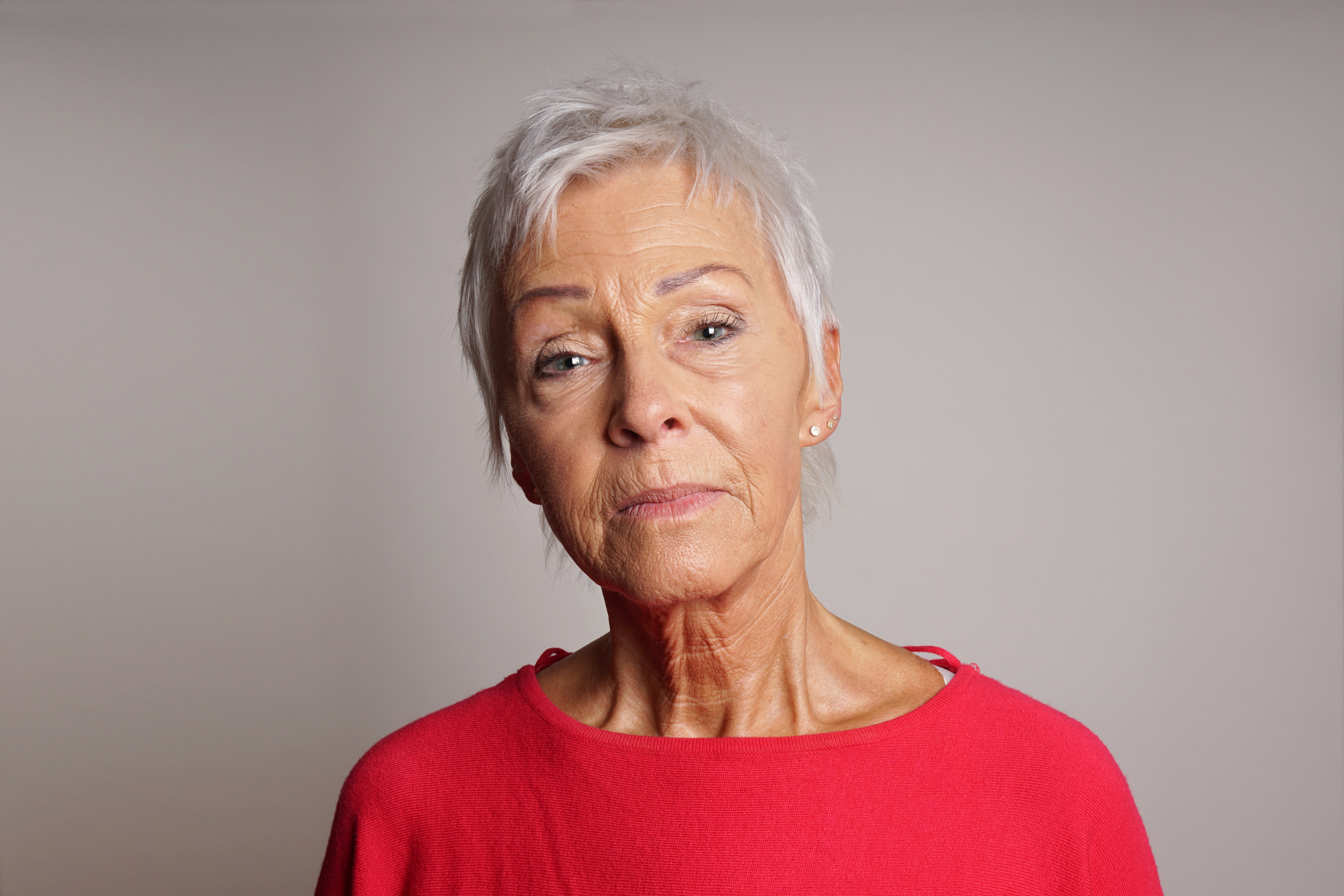femme avec visage affaiss&eacute; 