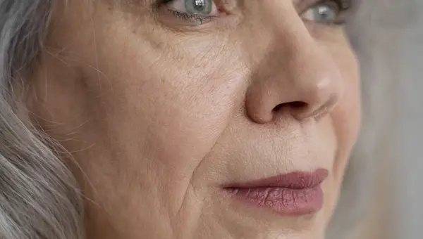 Comment enlever un &oelig;d&egrave;me du visage naturellement