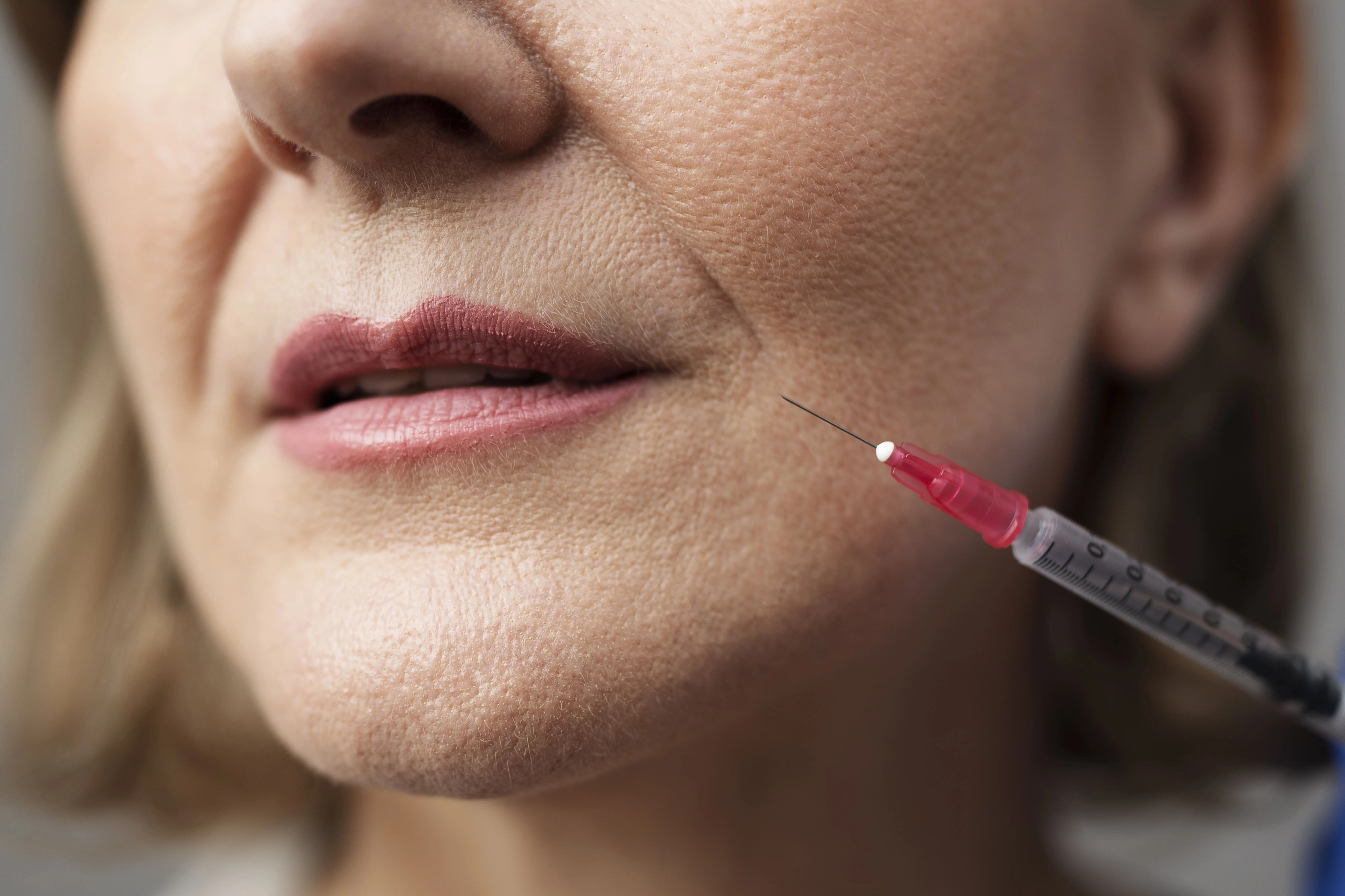 close-up-smiley-woman-with-hyaluronic-acid-injection-1