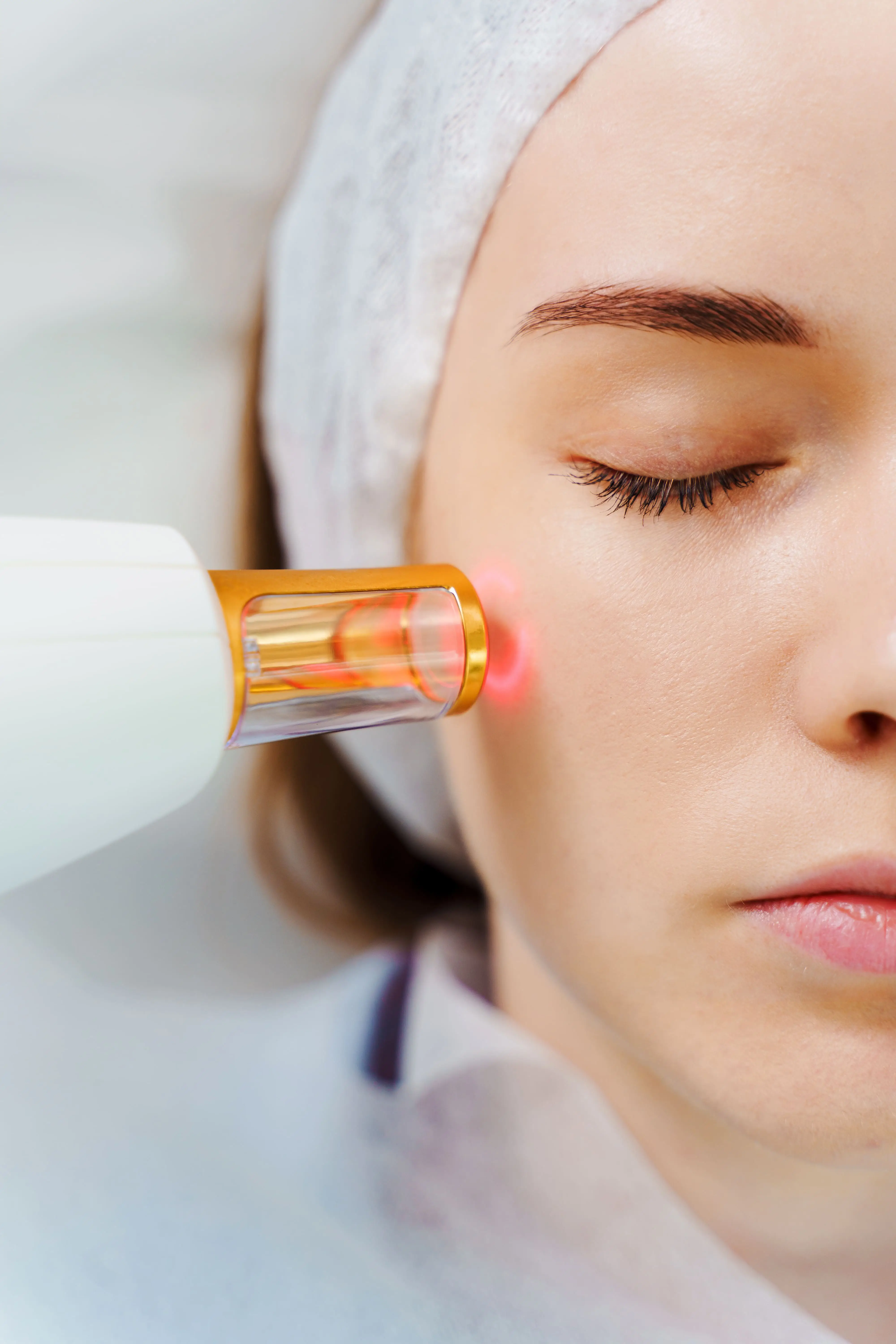 RF lifting du visage d&eacute;roulement