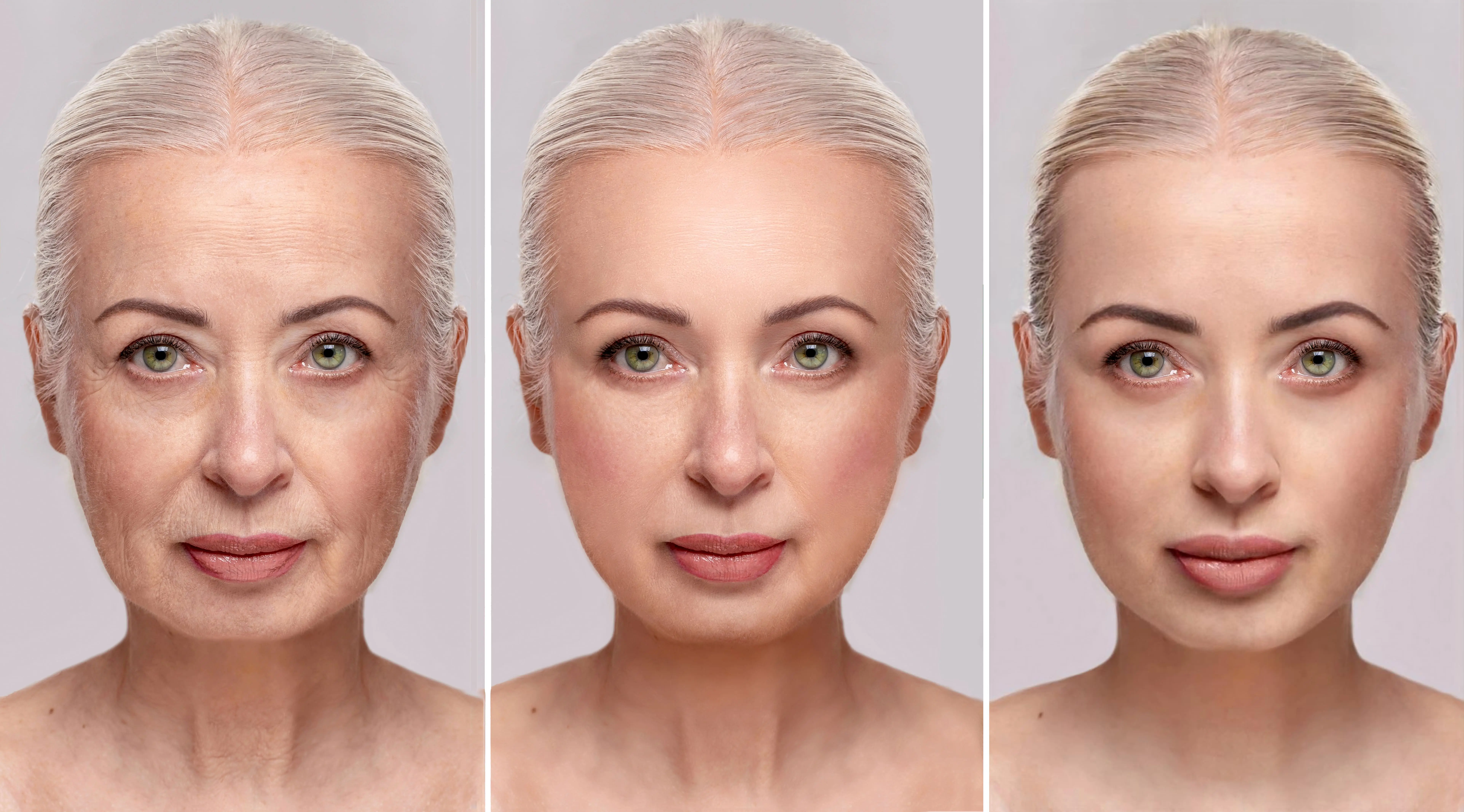 portrait-elderly-woman-before-after-skin-resurfacing-cosmetic-procedures-1