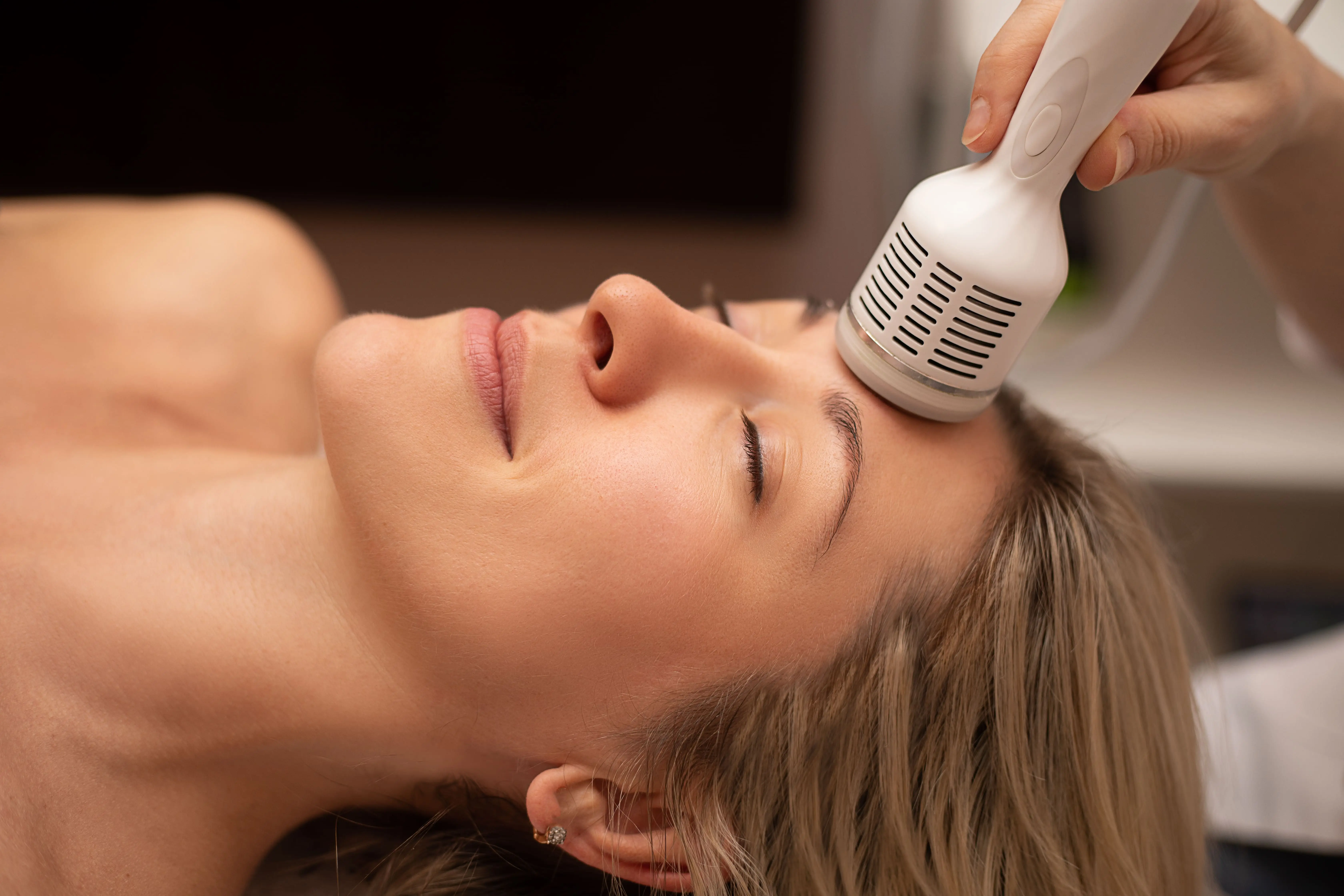 radiofr&eacute;quence visage lifting